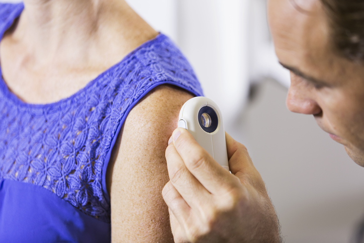 Should I be screened for Skin Cancer?